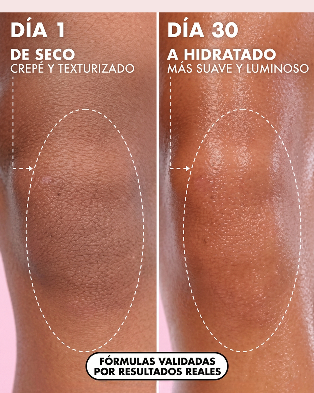 Goddess Glow™ - Aceite Regenerador Post-Depilación