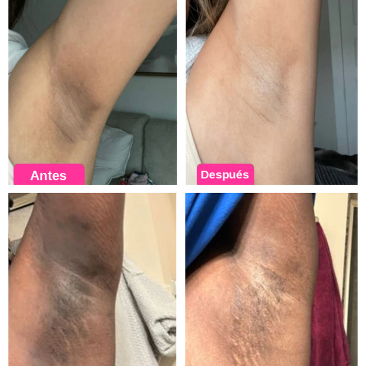 Peel Shot™ - Exfoliante Corporal Aclarante